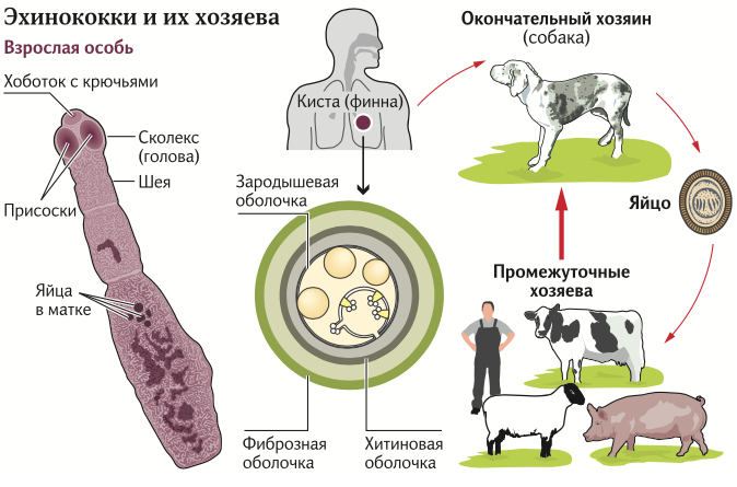 эхинококк